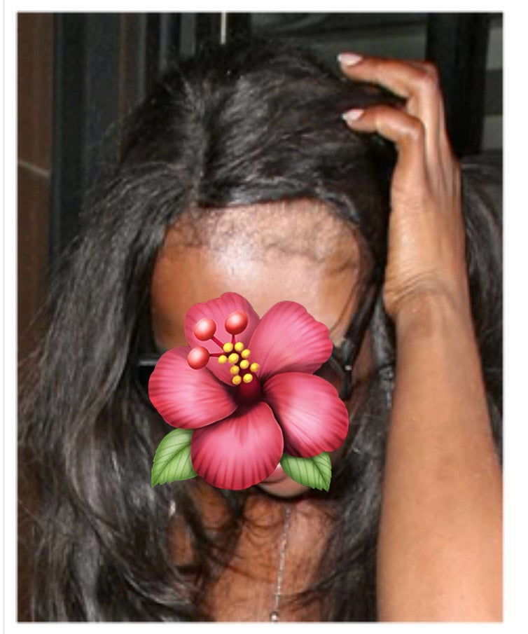Shampoing thérapeutique alopécie - Bio Amazônia - Perruque naturelle